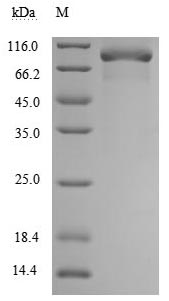 Greater than 90% as determined by SDS-PAGE.Recombinant Human Tumor Necrosis Factor Receptor Superfamily Member 11B (TNFRSF11B) Protein (hFc-Flag), Active