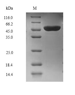 Greater than 90% as determined by SDS-PAGE.Recombinant Mouse Ubiquitin-Protein Ligase E3A (UBE3A) Protein (Flag-Myc)