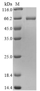 Greater than 90% as determined by SDS-PAGE.Recombinant Mouse Vimentin (VIM) Protein (His&Myc)