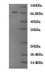 Greater than 90% as determined by SDS-PAGE.Recombinant Human Zyxin (ZYX) Protein (His)