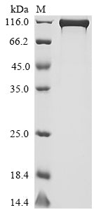 Greater than 90% as determined by SDS-PAGE.Recombinant Human Dipeptidyl Peptidase 4 (DPP4) Protein (hFc-Flag&Myc)