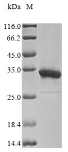 Image for Recombinant Hdv Large Delta Antigen (L-HDAG) Protein (His&Myc)