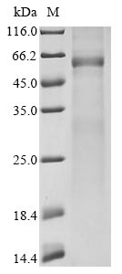Greater than 85% as determined by SDS-PAGE.Recombinant Avian Infectious Bronchitis Virus Nucleoprotein (N) Protein (His)