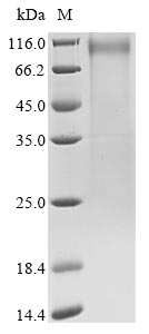 Greater than 85% as determined by SDS-PAGE.Recombinant Human Coronavirus 229E Spike Glycoprotein (S) Protein (His)