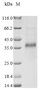 Greater than 85% as determined by SDS-PAGE.Recombinant Bovine Cathelicidin-1 (CATHL1) Protein (hFc-Myc)