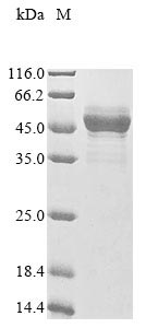 Greater than 85% as determined by SDS-PAGE.Recombinant Paeniclostridium Sordellii Sialidase Protein (His&Myc)
