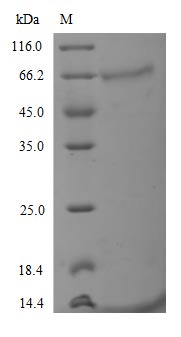 Greater than 90% as determined by SDS-PAGE.Recombinant Human Tyrosine-Protein Kinase Receptor Ufo (AXL) Protein (His)