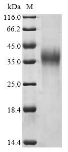 Greater than 90% as determined by SDS-PAGE.Recombinant Avian Infectious Bronchitis Virus Spike Glycoprotein (S) Protein (His)