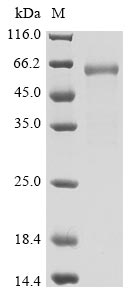 Greater than 90% as determined by SDS-PAGE.Biotinylated Recombinant Sars-Cov-2 Spike Glycoprotein (S) Protein (mFc-Avi)