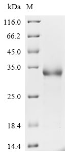 Greater than 90% as determined by SDS-PAGE.Recombinant SARS-CoV-2 Spike glycoprotein (S) Protein (His)