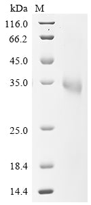 Greater than 90% as determined by SDS-PAGE.Recombinant Sars-Cov-2 Spike Glycoprotein (S) Protein (His)