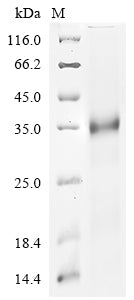Greater than 90% as determined by SDS-PAGE.Recombinant Sars-Cov-2 Spike Glycoprotein (S) Protein (His&Myc)