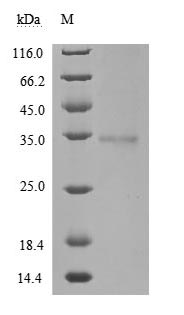 Greater than 85% as determined by SDS-PAGE.Recombinant Sars-Cov-2 Spike Glycoprotein (S) Protein (His), Active