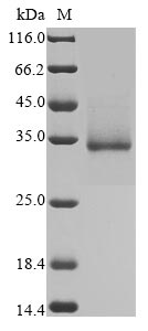 Image for Recombinant Sars-Cov-2 Spike Glycoprotein (S) Protein (His)