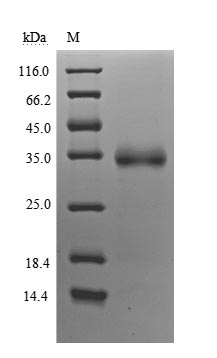 Greater than 90% as determined by SDS-PAGE.Recombinant Sars-Cov-2 Spike Glycoprotein (S) Protein (His), Active