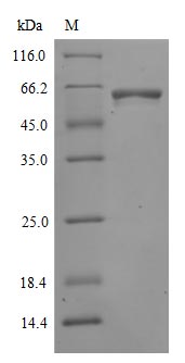 Greater than 90% as determined by SDS-PAGE.Recombinant Sars-Cov-2 Spike Glycoprotein (S) Protein (His-mFc), Active