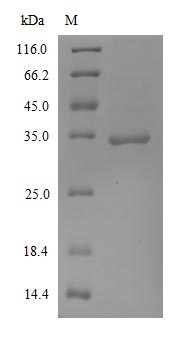 Greater than 90% as determined by SDS-PAGE.Recombinant Sars-Cov-2 Spike Glycoprotein (S) Protein (His)