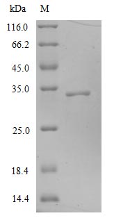 Greater than 90% as determined by SDS-PAGE.Recombinant Sars-Cov-2 Spike Glycoprotein (S) Protein (His)