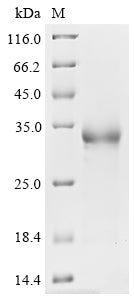 Greater than 90% as determined by SDS-PAGE.Recombinant Sars-Cov-2 Spike Glycoprotein (S) Protein (His)