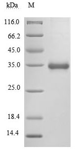 Greater than 90% as determined by SDS-PAGE.Recombinant Sars-Cov-2 Spike Glycoprotein (S) Protein (His&Myc), Active