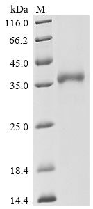 Greater than 90% as determined by SDS-PAGE.