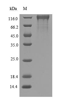 Greater than 90% as determined by SDS-PAGE.Recombinant Human Sars-Cov-2 Spike Glycoprotein (S) Protein (His), Active