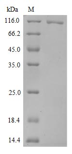 Greater than 90% as determined by SDS-PAGE.Recombinant Sars-Cov-2 Spike Glycoprotein (S) Protein (His)
