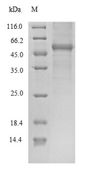 Greater than 85% as determined by SDS-PAGE.Recombinant Sars-Cov-2 Nucleoprotein (N)