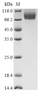 Greater than 90% as determined by SDS-PAGE.Recombinant Mouse Carboxylesterase 1C (CES1C) Protein (His&Myc)