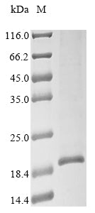 Greater than 85% as determined by SDS-PAGE.Recombinant Human Putative Teratocarcinoma-Derived Growth Factor 3 (TDGF1P3) Protein (His)