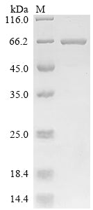 Greater than 90% as determined by SDS-PAGE.Biotinylated Recombinant Lordsdale Virus Capsid Protein (ORF2) Protein (His&Myc-avi)