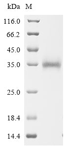 Greater than 90% as determined by SDS-PAGE.Recombinant Severe Acute Respiratory Syndrome Coronavirus Spike Glycoprotein (S) Protein (His)