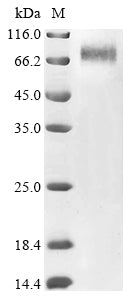 Greater than 90% as determined by SDS-PAGE.Recombinant Human Adenovirus C Serotype 5 Hexon Protein (L3) Protein (hFc)