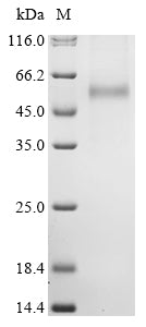 Greater than 90% as determined by SDS-PAGE.Recombinant Hantaan Virus Envelopment Polyprotein (GP) Protein (His)