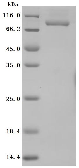 Greater than 95% as determined by SDS-PAGE.Recombinant Human Transferrin Receptor Protein 1 (TFRC) Protein (His), Active