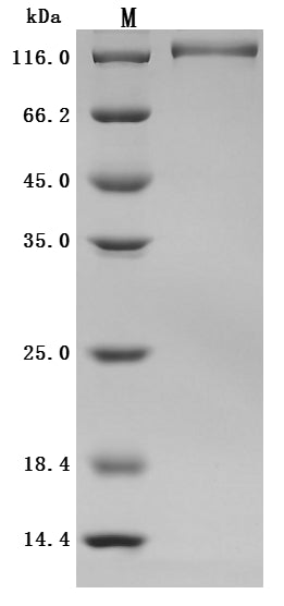 Greater than 95% as determined by SDS-PAGE.Recombinant Cynomolgus Monkey Ectonucleotide Pyrophosphatase/Phosphodiesterase 3 (ENPP3) Protein (His), Active