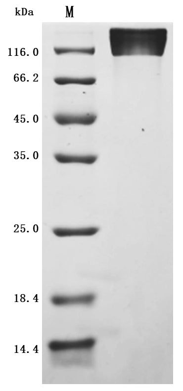 Greater than 95% as determined by SDS-PAGE.Recombinant Cynomolgus Monkey Cd44 Antigen (CD44) Protein (His), Active