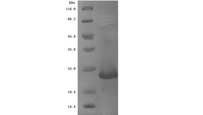 Greater than 90% as determined by SDS-PAGE.Recombinant Cynomolgus Monkey Zymogen Granule Protein 16 Homolog B (ZG16B) Protein (His), Active