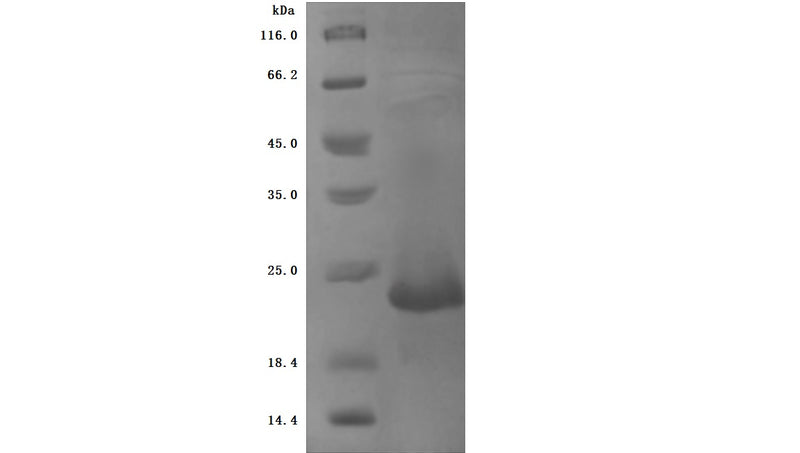 Greater than 90% as determined by SDS-PAGE.Recombinant Cynomolgus Monkey Zymogen Granule Protein 16 Homolog B (ZG16B) Protein (His), Active