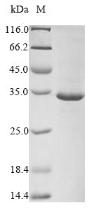 Greater than 85% as determined by SDS-PAGE.Recombinant Zaire Ebolavirus Membrane-Associated Protein Vp24 (VP24) Protein (His&Myc)
