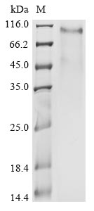 Greater than 85% as determined by SDS-PAGE.Recombinant Human Coronavirus Hku1 Spike Glycoprotein (S) Protein (mFc)