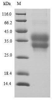 Greater than 95% as determined by SDS-PAGE.Recombinant Human Programmed Cell Death Protein 1 (PDCD1) Protein (His), Active