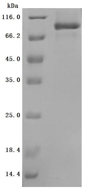 Greater than 95% as determined by SDS-PAGE.Recombinant Human Desmoglein-2 (DSG2) Protein (His), Active