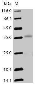 Greater than 90% as determined by SDS-PAGE.Recombinant Human Oligodendrocyte Transcription Factor 2 (OLIG2) Protein (His)