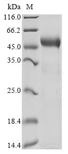 Greater than 90% as determined by SDS-PAGE.Recombinant Human Disco-Interacting Protein 2 Homolog A (DIP2A) Protein (hFc)