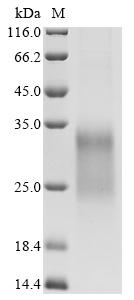Greater than 90% as determined by SDS-PAGE.Recombinant Mouse Igf-Like Family Receptor 1 (IGFLR1) Protein (His)