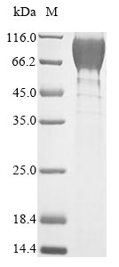 Greater than 85% as determined by SDS-PAGE.Recombinant Mouse Heat-Stable Enterotoxin Receptor (GUCY2C) Protein (His&Myc)