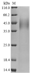 Greater than 90% as determined by SDS-PAGE.Recombinant Human Protein Mono-Adp-Ribosyltransferase Parp14 (PARP14) Protein (His&Myc)