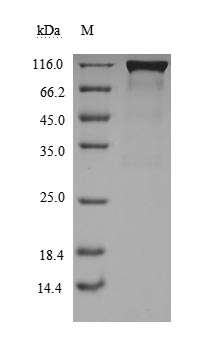 Greater than 90% as determined by SDS-PAGE.Recombinant Paguma Larvata Angiotensin-Converting Enzyme 2 (ACE2) Protein (hFc), Active
