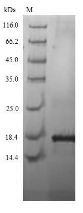 Greater than 90% as determined by SDS-PAGE.Recombinant Human Kita-Kyushu Lung Cancer Antigen 1 (CT83) Protein (His)
